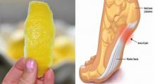 Una cáscara de limón puede quitar el dolor de las articulaciones para siempre.