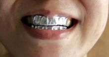 Ella cubrió sus dientes con papel de aluminio por 15 minutos. ¡El resultado te sorprenderá!