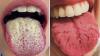 9 Señales de Alerta que tu lengua te está enviando ¡No las ignores!