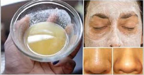 Como usar el bicarbonato de sodio para hacer su cara y piel mas hermosa!