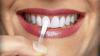 El método más rápido y eficaz para blanquear dientes
